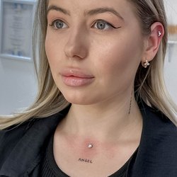 Microdermal